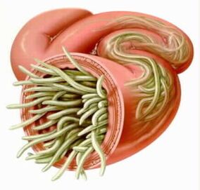 Parasitas no intestino