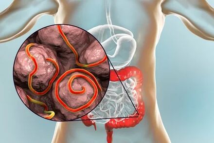 Parasitas no intestino