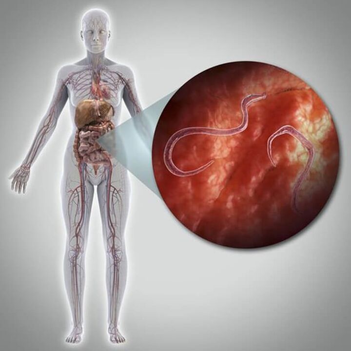 Parasitas no corpo de uma pessoa