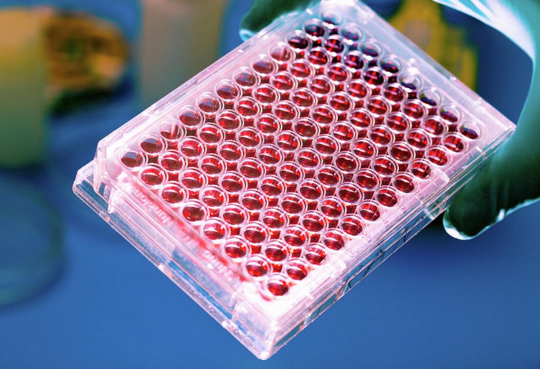 exame de sangue para parasitas