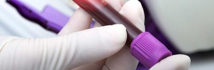 sangue para teste de parasita