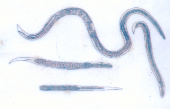 O verme da Guiné, que parasita sob a pele, é fácil de ser infectado