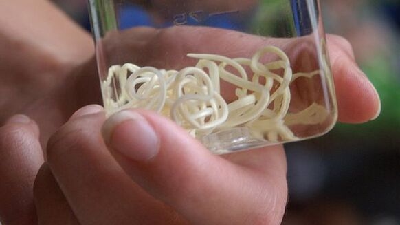 Os vermes Filaria lembram um longo fio na aparência